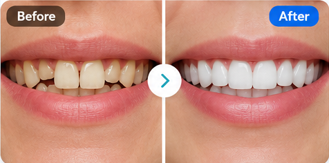 Smile Makeover